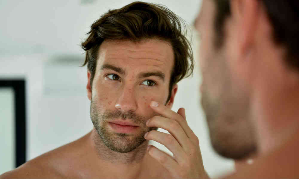 Homem No Espelho - Como tratar acne
