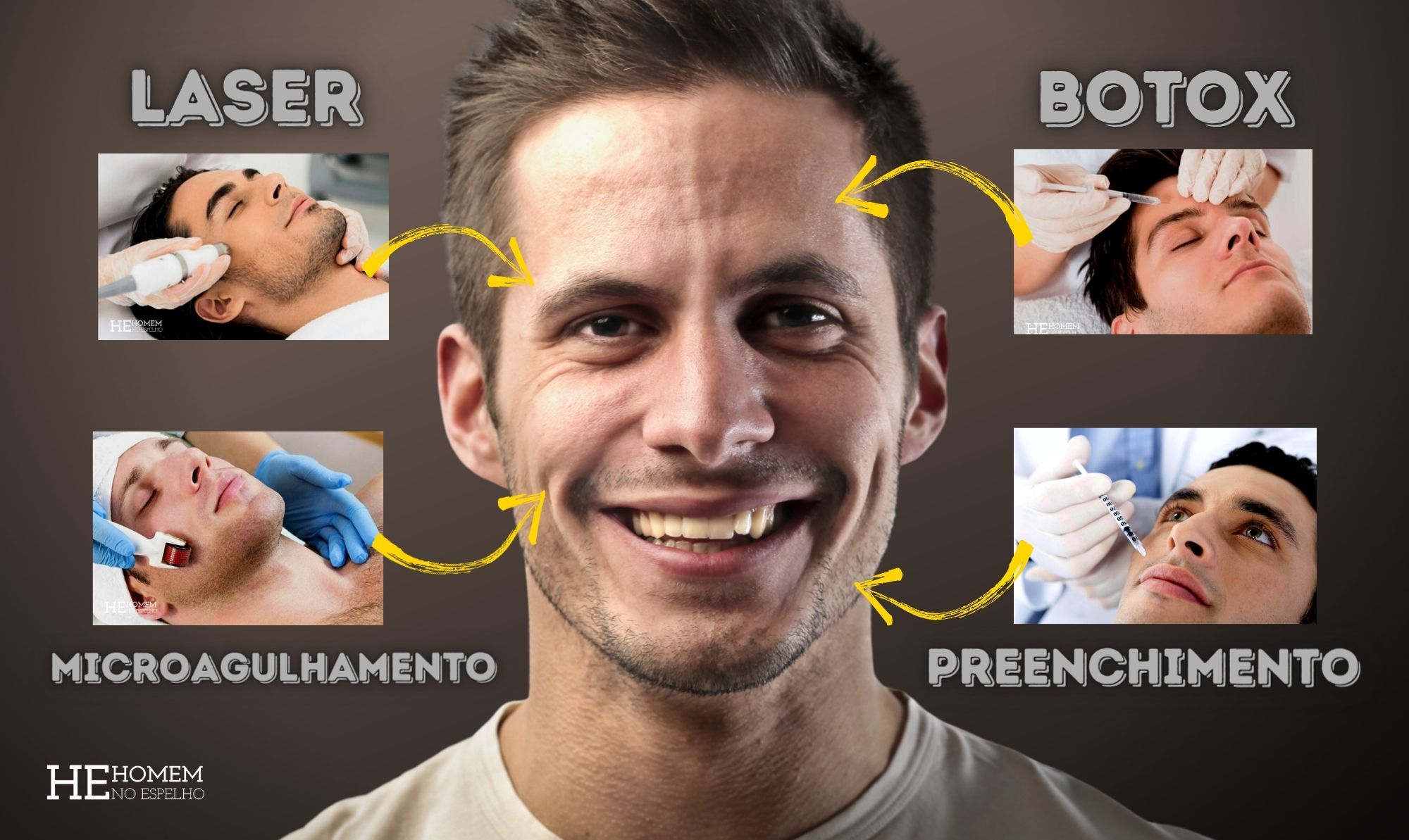 Os melhores procedimentos dermatológicos para o rosto do homem