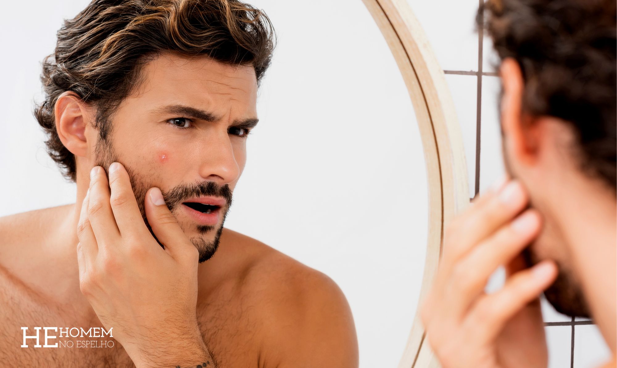 Homem No Espelho - Efeitos do estresse na pele - acne