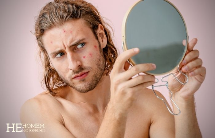 Homem No Espelho - Efeitos do estresse na pele - acne - rugas