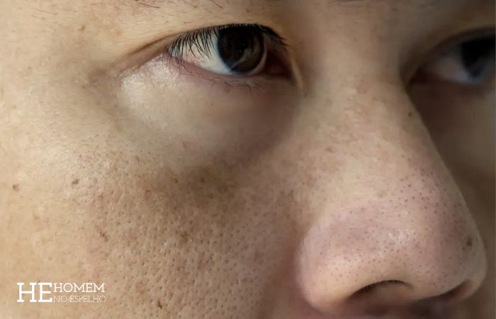 Homem No Espelho - Brancos, negros, morenos, orientais: os pontos fortes e fracos de cada pele