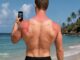 Homem No Espelho - A queimadura da praia não é o pior dano do sol na pele