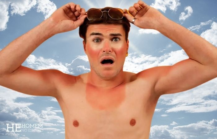 Homem No Espelho - A queimadura da praia não é o pior dano do sol na pele